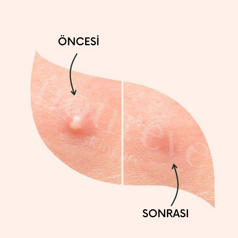 -Deep Pore Cleanser | Akne, Siyah Nokta & Komedon Karşıtı Temizleme Jeli | Salisilik Asit, Çay Ağacı Yağı