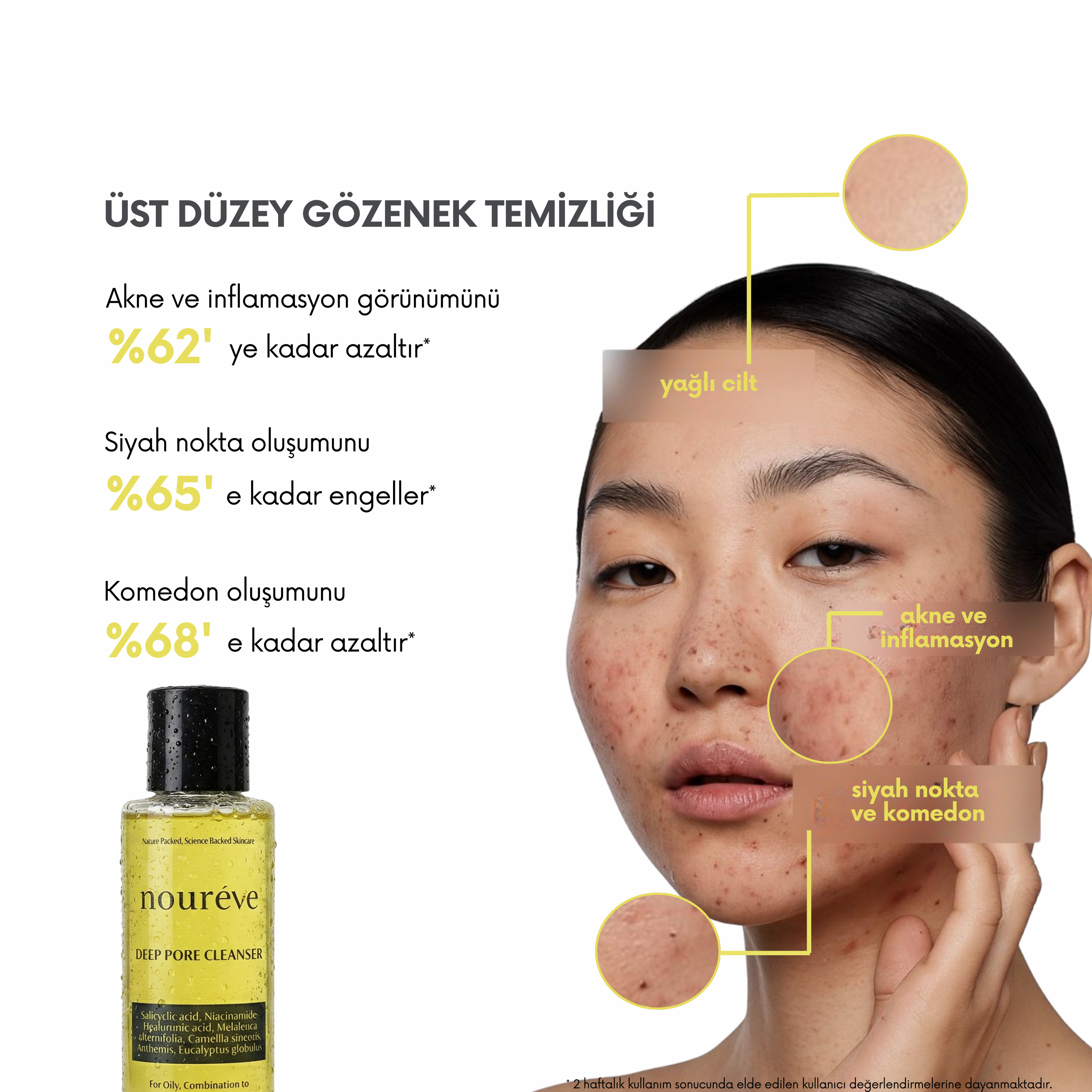 -Deep Pore Cleanser | Akne, Siyah Nokta & Komedon Karşıtı Temizleme Jeli | Salisilik Asit, Çay Ağacı Yağı